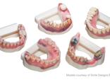 Color dental model​s