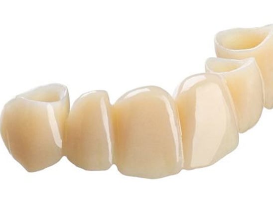 The TrueDent Difference: A new resin for 3D printing of permanent dentures and temporary crowns and bridges.