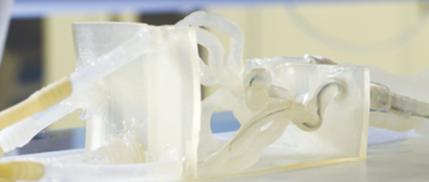 Jacobs Institute medical collaborators pioneer 3D printing solutions.