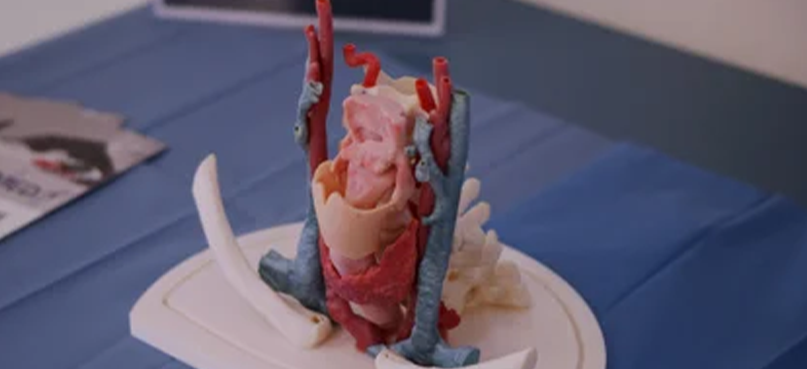 Exploring the Potential of 3D Printing in the Medical Field